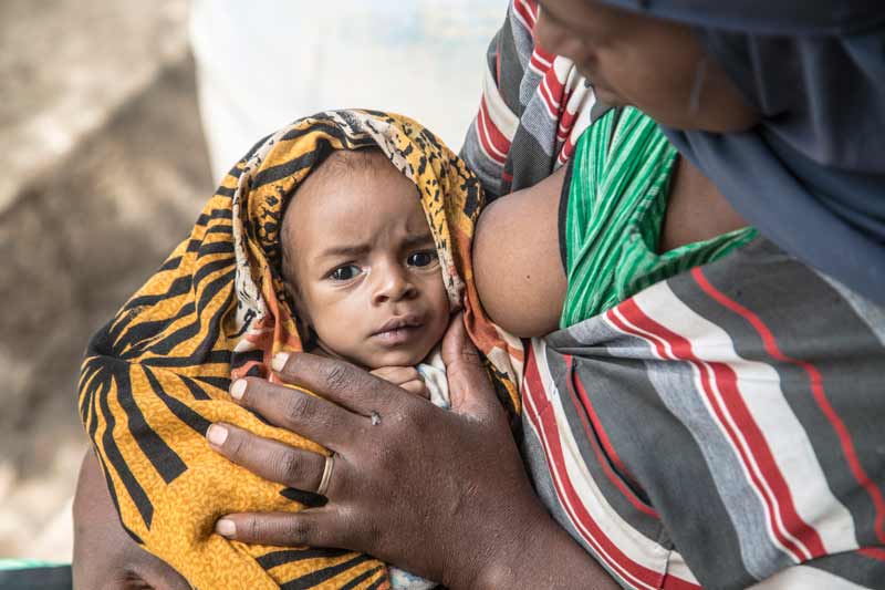 Baby suffers from severe acute malnutrition in Chinaksen